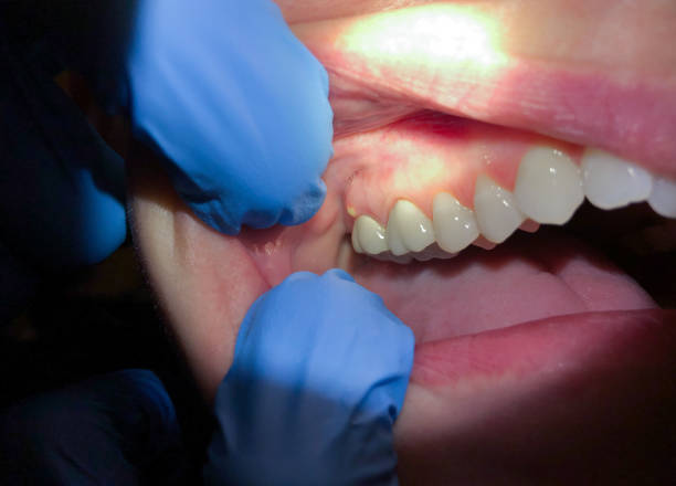 Best Cosmetic Emergency Dentistry in Rio Grande, OH